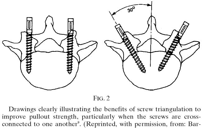 Spinal Pedicle Screw Fixation 1